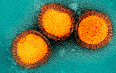 Influenza B virus particles, colorized gold, isolated from a patient sample.