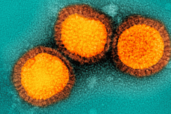 Influenza B virus particles, colorized gold, isolated from a patient sample.