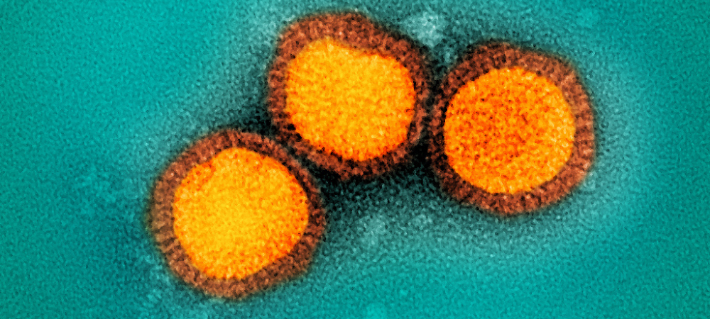 Influenza B virus particles, colorized gold, isolated from a patient sample.