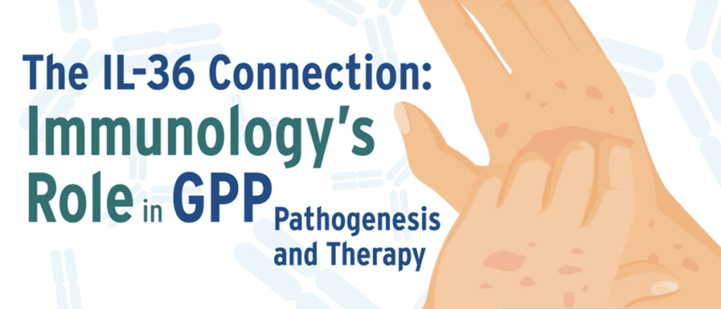 The IL-36 Connection: Immunology's Role in GPP Pathogenesis and Therapy